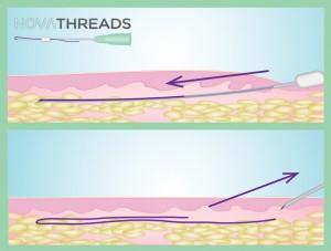 How PDO Threads Work How PDO Threads Work