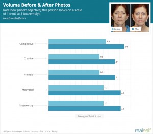 Voluma