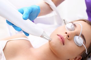 Cosmetic Treatments For Acne Scars