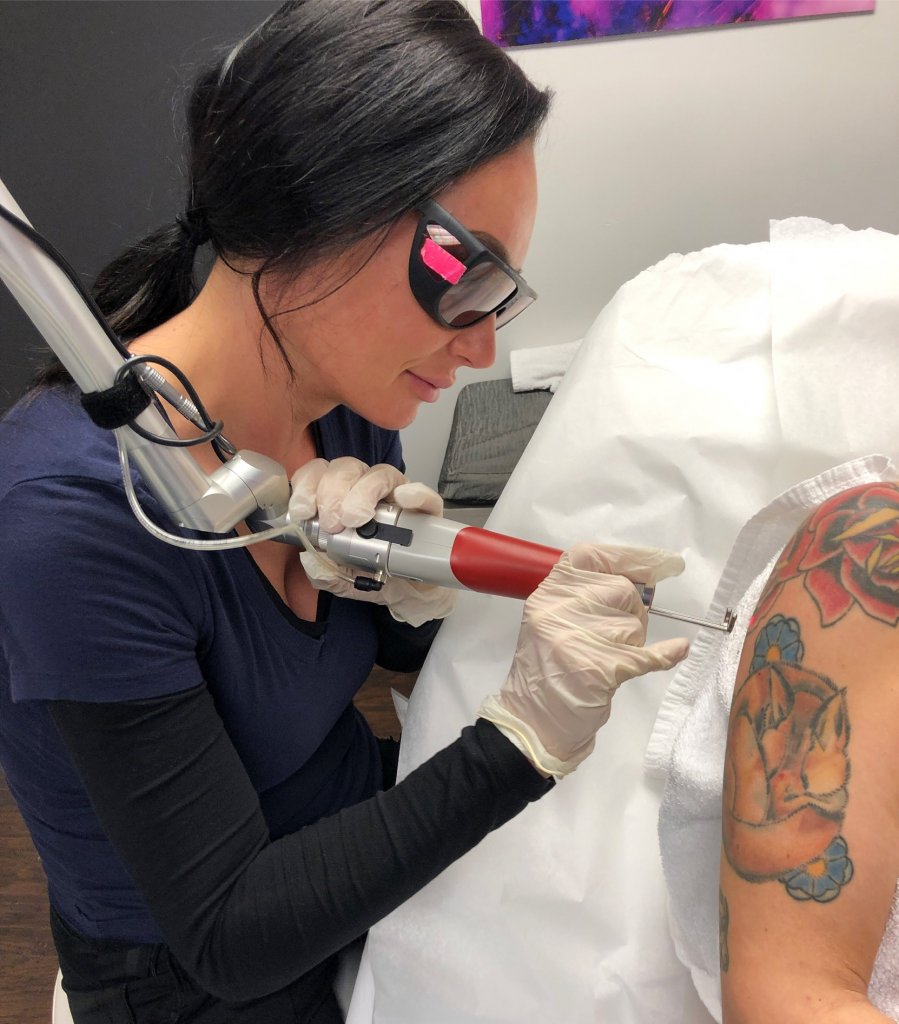 Non laser tattoo removal training  What the difference between laser and  non laser tattoo removal  OM SPA Microblading Academy Chicago   Microblading Training Chicago