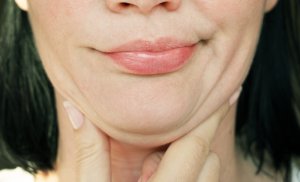 Kybella For Neck Contouring