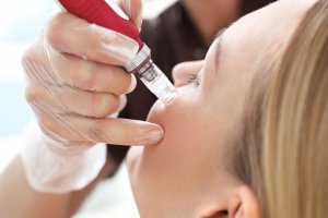 Microneedling Training For Estheticians