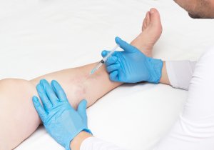 Sclerotherapy Training in Arizona