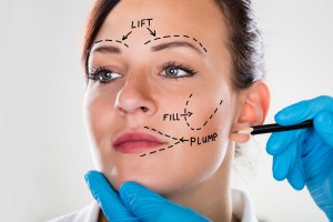 What Is A Nonsurgical Facelift