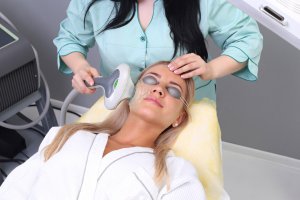 bbl acne photofacial