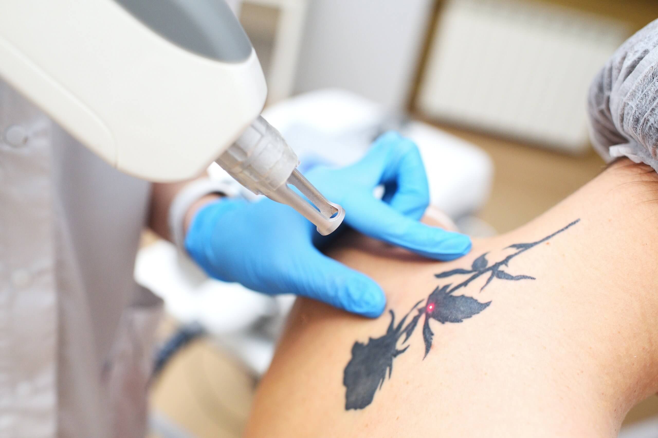 a cosmetic laser technician career can lead to more cosmetic laser tattoo removal treatments in your repertoire. 