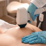 A National Laser Institute instructor gives a treatment during laser hair removal training in Scottsdale, Arizona.