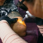A National Laser Institute laser technician graduate from our tattoo removal school in Phoenix, AZ works on his client.