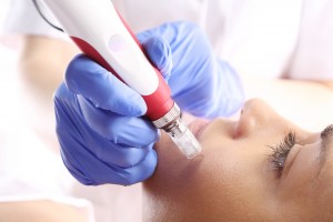 prp facial training with microneedling