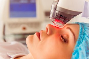 changes in cosmetic lasers