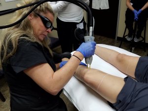 training laser hair removal